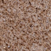 Anti-FABP7 antibody produced in rabbit Prestige Antibodies® Powered by Atlas Antibodies, affinity isolated antibody, buffered aqueous glycerol solution