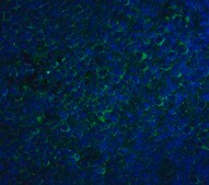 Anti-CCR5 antibody produced in rabbit affinity isolated antibody