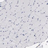 Anti-ICAM1 antibody produced in rabbit Prestige Antibodies® Powered by Atlas Antibodies, affinity isolated antibody, buffered aqueous glycerol solution