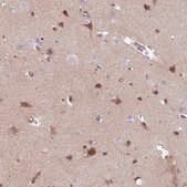 Anti-TMEM132A antibody produced in rabbit Prestige Antibodies® Powered by Atlas Antibodies, affinity isolated antibody, buffered aqueous glycerol solution