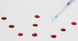 Clostridium perfringens NCTC 13170 Lenticule® discs 500-50000 CFU, suitable for microbiology, certified reference material, Manufactured by: Sigma-Aldrich Production GmbH, Switzerland