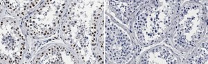 Anti-CBP Antibody, clone 3N20 ZooMAb® Rabbit Monoclonal recombinant, expressed in HEK 293 cells