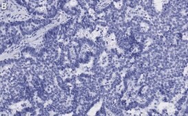 Anti-p-ATM (Ser1981) Antibody, clone 1E19, ZooMAb® Rabbit Monoclonal recombinant, expressed in HEK 293 cells