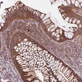 Anti-TTC19 antibody produced in rabbit Prestige Antibodies® Powered by Atlas Antibodies, affinity isolated antibody, buffered aqueous glycerol solution
