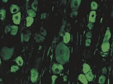 Anti-Internexin α Antibody serum, Chemicon®