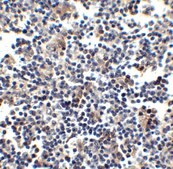 Anti-CCR5 antibody produced in rabbit affinity isolated antibody