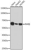 Anti-RARβ Antibody, clone 6D5V4, Rabbit Monoclonal