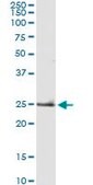 Monoclonal Anti-TNF antibody produced in mouse clone M1-C4, purified immunoglobulin, buffered aqueous solution
