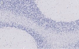 Anti-Bin1 Antibody, clone 99D.2 ZooMAb® Mouse Monoclonal recombinant, expressed in HEK 293 cells