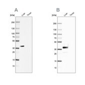 Anti-ARG1 antibody produced in rabbit Prestige Antibodies® Powered by Atlas Antibodies, affinity isolated antibody, buffered aqueous glycerol solution