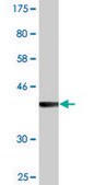 Monoclonal Anti-VCP, (N-terminal) antibody produced in mouse clone 2B2, purified immunoglobulin, buffered aqueous solution