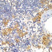 Anti-NOTCH1 antibody produced in rabbit