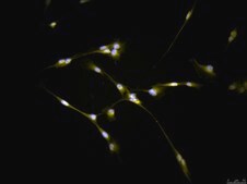 CNS-1 Rat Glioma Cell Line