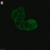Anti-TSG101 Antibody, clone 2H18 ZooMAb® Rabbit Monoclonal recombinant, expressed in HEK 293 cells