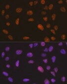 Anti- SMARCB1/SNF5 antibody produced in rabbit