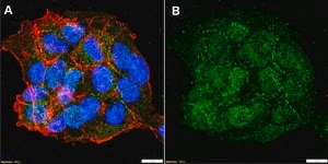 Anti-S100A1 Antibody, clone 1D18 ZooMAb® Rabbit Monoclonal recombinant, expressed in HEK 293 cells