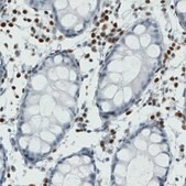 Monoclonal Anti-RUNX2 antibody produced in mouse Prestige Antibodies® Powered by Atlas Antibodies, clone CL0232, purified immunoglobulin, buffered aqueous glycerol solution