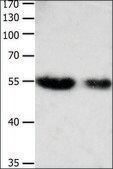 Anti-CBFA1 antibody produced in rabbit affinity isolated antibody