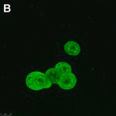 Anti-phospho-ULK1-Ser555 Antibody, clone 1E17 ZooMAb® Rabbit Monoclonal recombinant, expressed in HEK 293 cells