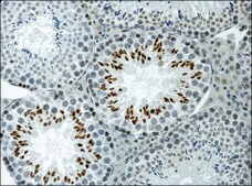 Anti-acetyl-Histone H3 (Ac-Lys9) antibody produced in rabbit 2-2.5 mg/mL, affinity isolated antibody, buffered aqueous solution