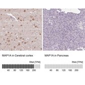 Anti-MAP1A antibody produced in rabbit Prestige Antibodies® Powered by Atlas Antibodies, affinity isolated antibody, buffered aqueous glycerol solution