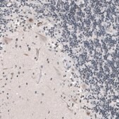 Anti-KMT5C antibody produced in rabbit Prestige Antibodies® Powered by Atlas Antibodies, affinity isolated antibody, buffered aqueous glycerol solution