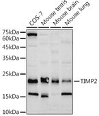 Anti-TIMP2 Antibody, clone 8R5Q2, Rabbit Monoclonal