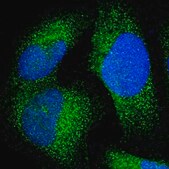 Anti-JMJD7 antibody produced in rabbit Prestige Antibodies® Powered by Atlas Antibodies, affinity isolated antibody, buffered aqueous glycerol solution