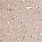 Anti-CLOCK antibody produced in rabbit Prestige Antibodies® Powered by Atlas Antibodies, affinity isolated antibody, buffered aqueous glycerol solution