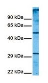 抗 SLC1A5 IgG fraction of antiserum