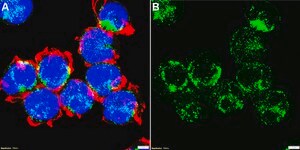 Anti-Interleukin-21 Antibody, clone 2B13 ZooMAb® Rabbit Monoclonal recombinant, expressed in HEK 293 cells
