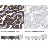 Anti-RUVBL1 antibody produced in rabbit Prestige Antibodies® Powered by Atlas Antibodies, affinity isolated antibody, buffered aqueous glycerol solution