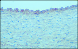 单克隆抗 硫酸软骨素 小鼠抗 clone CS-56, ascites fluid
