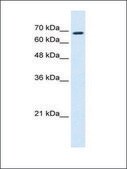 Anti-RHOT1 antibody produced in rabbit affinity isolated antibody