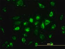 Monoclonal Anti-ACAA2 antibody produced in mouse clone 5C4, purified immunoglobulin, buffered aqueous solution