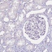 Anti-IL2RA antibody produced in rabbit Prestige Antibodies® Powered by Atlas Antibodies, affinity isolated antibody, buffered aqueous glycerol solution