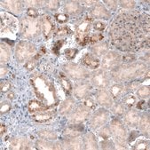 Monoclonal Anti-CLIP1 antibody produced in mouse Prestige Antibodies® Powered by Atlas Antibodies, clone CL4844, purified immunoglobulin, buffered aqueous glycerol solution