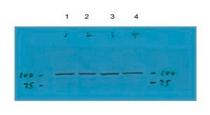 Anti-TRPC6 antibody produced in rabbit affinity isolated antibody