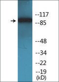 抗-磷酸化-ADAM 17 (pThr735) 兔抗 affinity isolated antibody