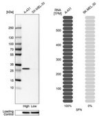 Anti-SFN antibody produced in rabbit Prestige Antibodies® Powered by Atlas Antibodies, affinity isolated antibody, buffered aqueous glycerol solution
