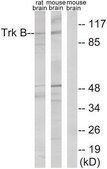 Anti-TRK B antibody produced in rabbit affinity isolated antibody