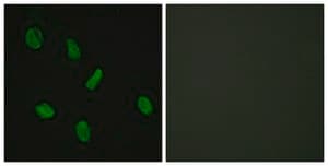 Anti-Androgen Receptor, N-Terminal antibody produced in rabbit affinity isolated antibody