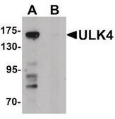 Anti-ULK4 antibody produced in rabbit affinity isolated antibody