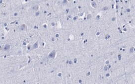 Anti-α-synuclein Antibody, clone 1D22 ZooMAb® Rabbit Monoclonal recombinant, expressed in HEK 293 cells