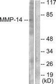 Anti-MMP-14 antibody produced in rabbit affinity isolated antibody