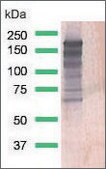Anti-EGFR antibody, Rabbit monoclonal clone SP111, recombinant, expressed in proprietary host, affinity isolated antibody