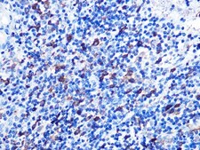 Anti-Stathmin 1 antibody produced in rabbit