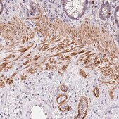 Anti-SMTN antibody produced in rabbit Prestige Antibodies® Powered by Atlas Antibodies, affinity isolated antibody, buffered aqueous glycerol solution