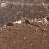 Anti-YWHAB antibody produced in rabbit Prestige Antibodies® Powered by Atlas Antibodies, affinity isolated antibody, buffered aqueous glycerol solution