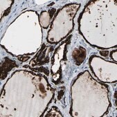 抗 TPO 兔抗 Prestige Antibodies® Powered by Atlas Antibodies, affinity isolated antibody, buffered aqueous glycerol solution